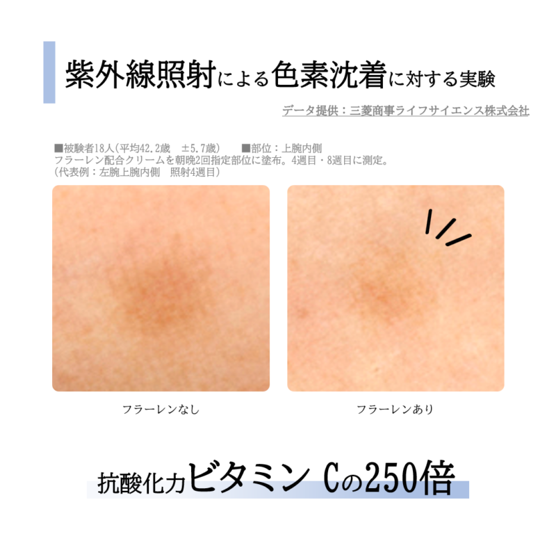 SC EXSOME W　エスシー EXソーム W - 画像 (3)