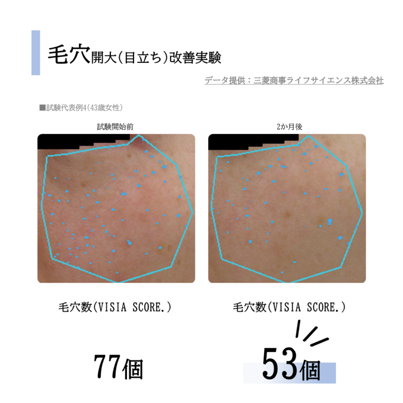 SC EXSOME W　エスシー EXソーム W - 画像 (4)